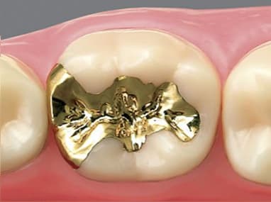 川越（川越駅西口すぐ）の歯医者で審美歯科