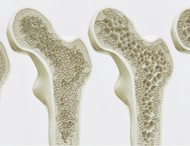 川越（川越駅西口すぐ）の歯医者でインプラント