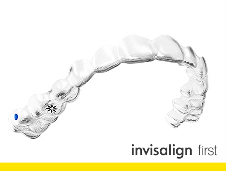 川越（川越駅西口すぐ）の歯医者で子どもの矯正