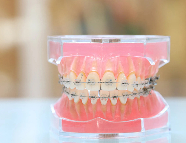 川越駅西口すぐの歯医者、グリーン歯科・矯正歯科の日本矯正歯科学会認定医による矯正治療